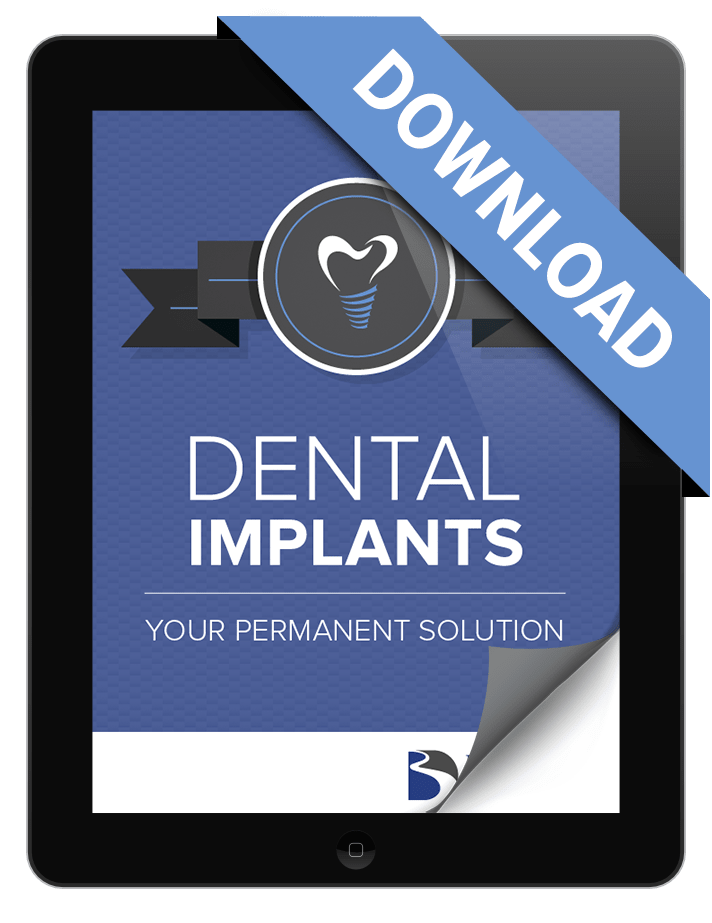Download our free dental implant ebook