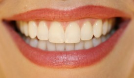 Great Smile Visit Dentist Regularly 